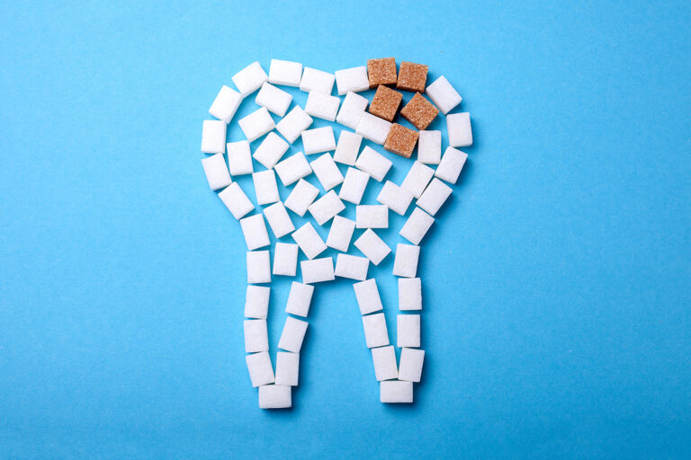 Treatment of Caries