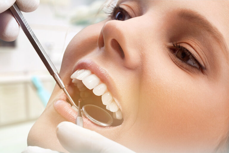 Periodontitis Treatment